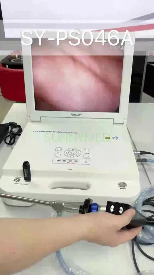 Telecamera per endoscopio per artroscopia con sistema endoscopico completamente HD