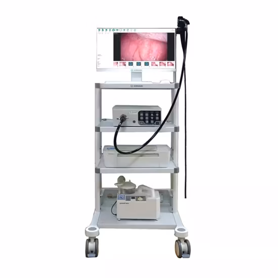 Endoscopio per colonscopio gastroscopio digitale per video endoscopia con operazione HD di vendita calda dell'ospedale medico